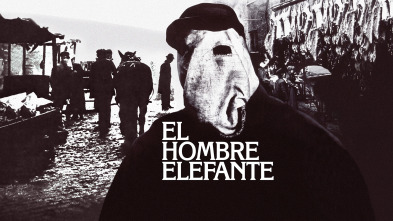 El hombre elefante